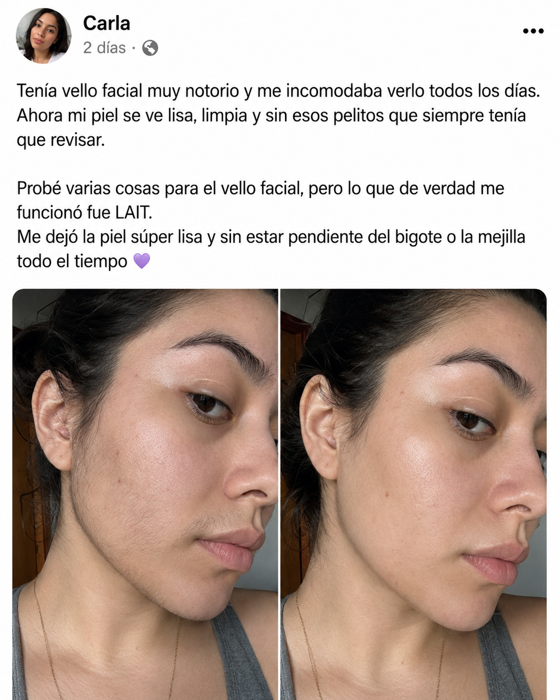 LAIT. - Elimina el vello visible en menos de 1 minuto.