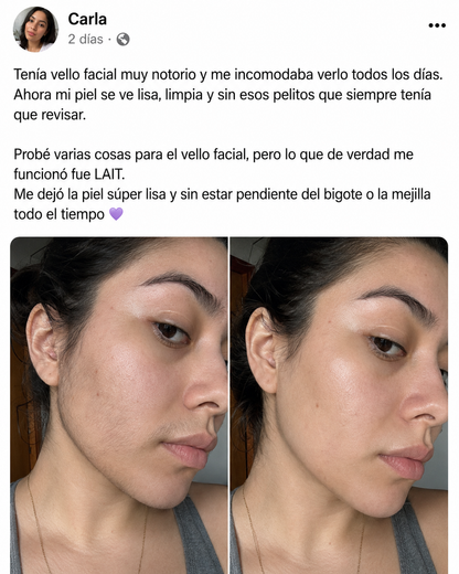 LAIT. - Elimina el vello visible en menos de 1 minuto.